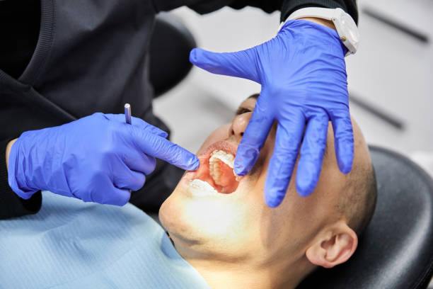 Best Emergency Tooth Extraction in Greenwood, LA