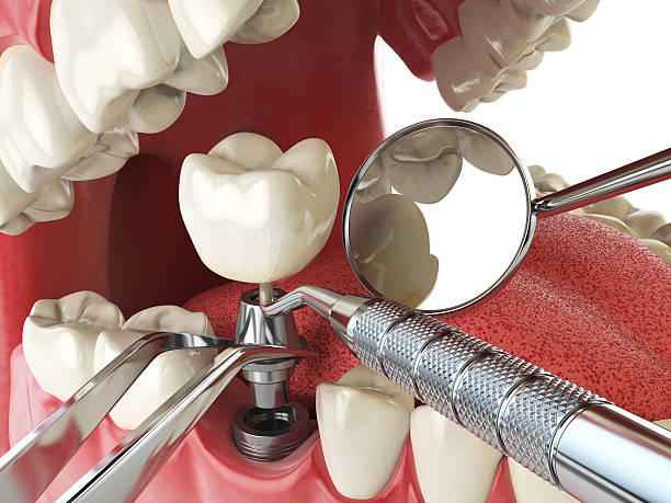 Best Emergency TMJ Treatment in Greenwood, LA